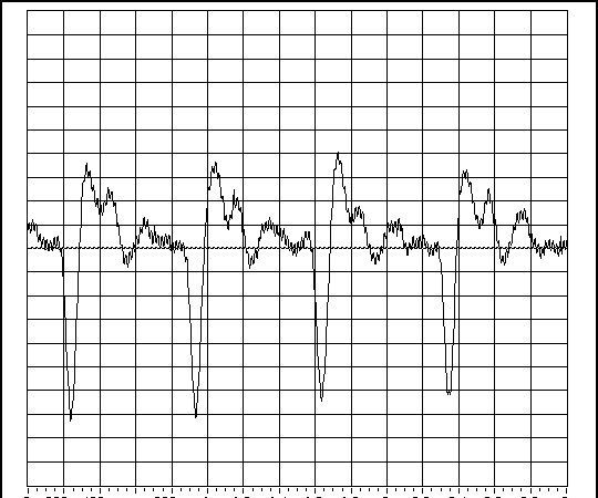 Another ECG Frontend