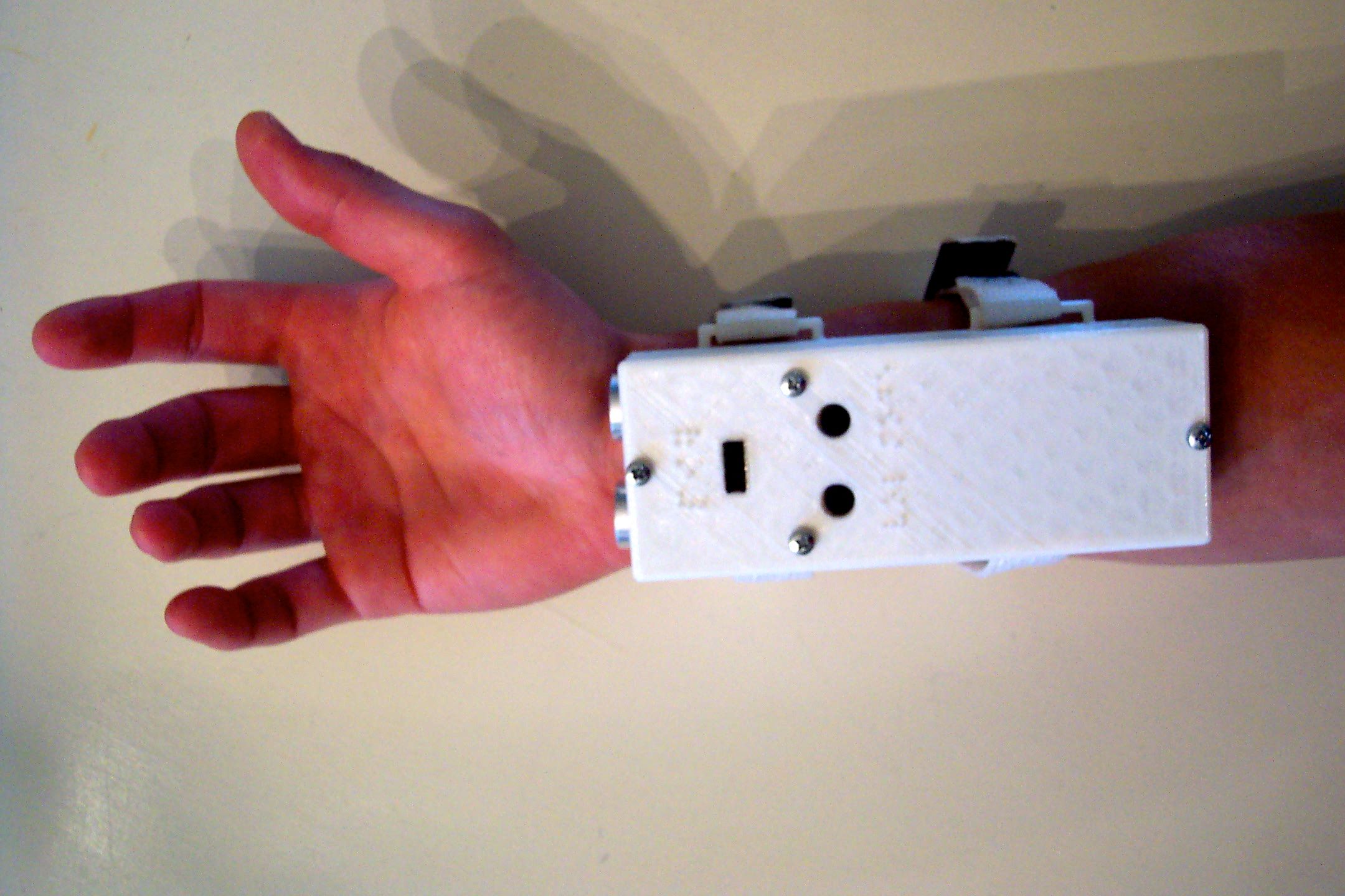 VIA (Visual Impairment Aid) 8 Steps (with Pictures) Instructables