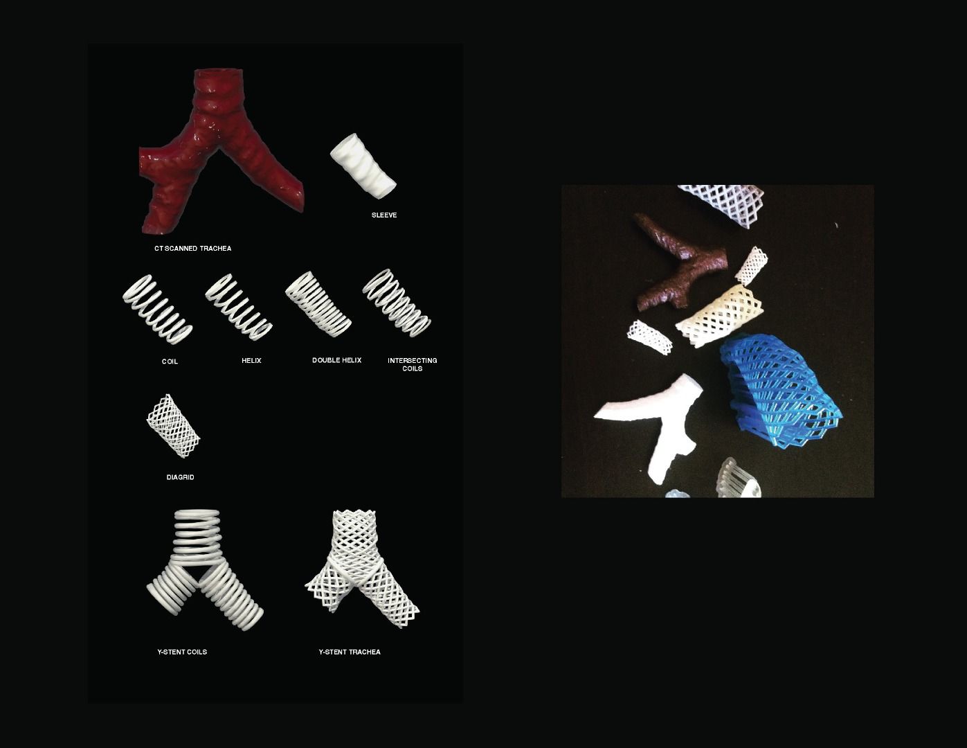 Create a Custom 3D Printable Prosthetic Device Using Data From a CT ...