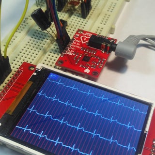ECG Display With Arduino : 13 Steps (with Pictures) - Instructables