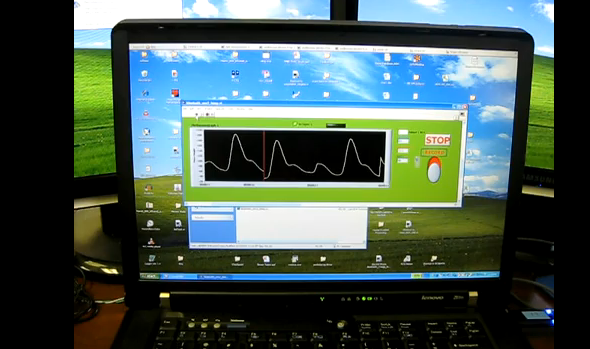 Bluetooth Pulse Oximeter