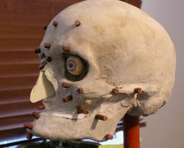Adding the Nasal Cartilage