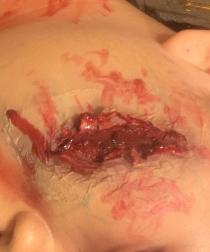 Quick and Easy Way to Make a Fake Wound