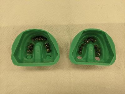 Form the Wax Base