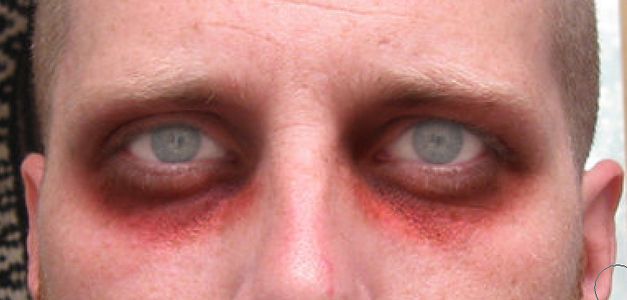 Step Four: Get Sullen Eyes and Cheeks.