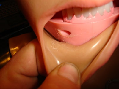 Finnishing the Skin Removal