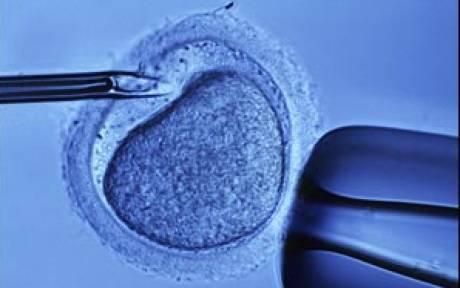 Cost of IVF Treatment and Egg Donation Center in India