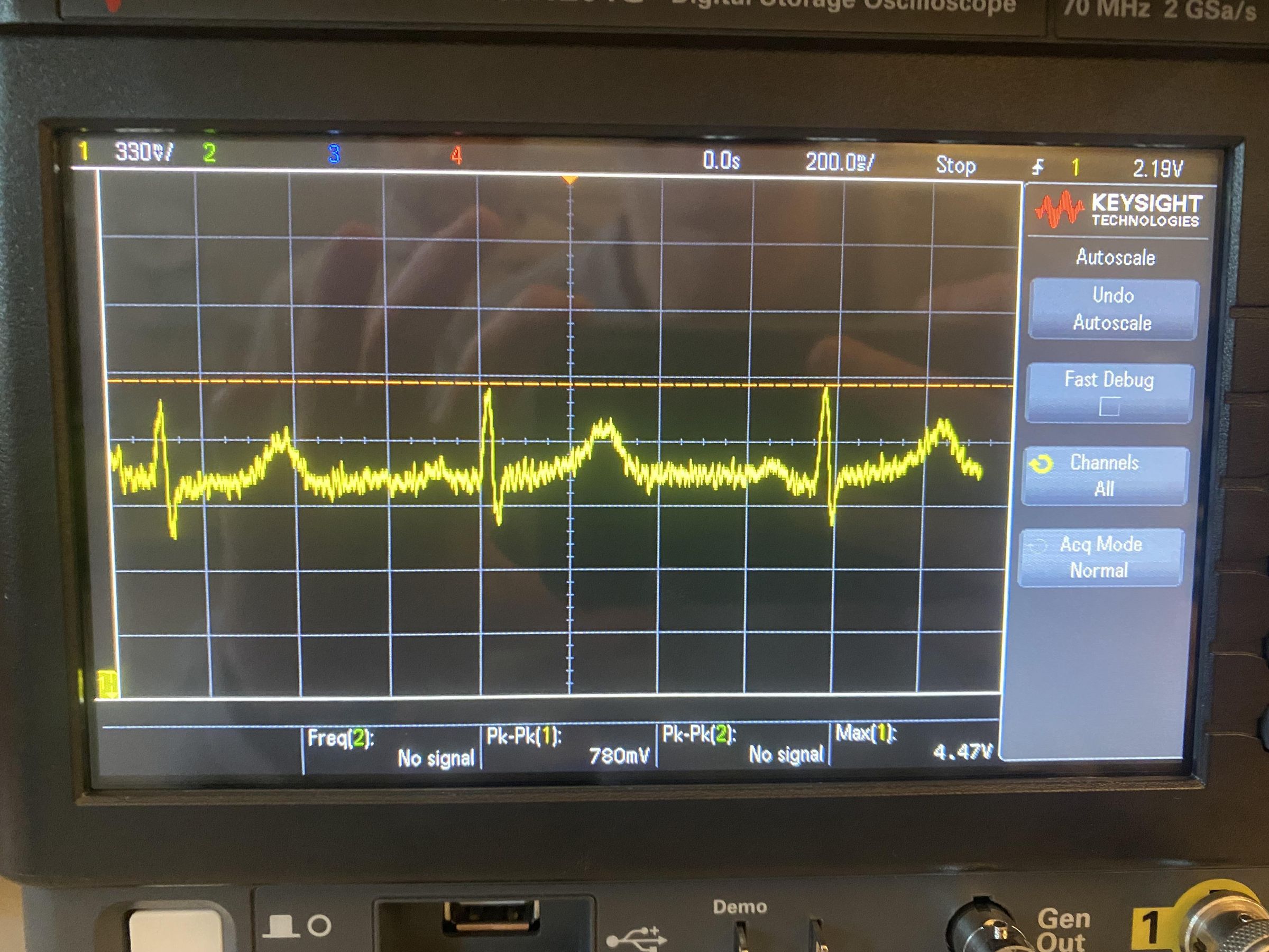 How to Make an Electrocardiogram (ECG) : 7 Steps - Instructables