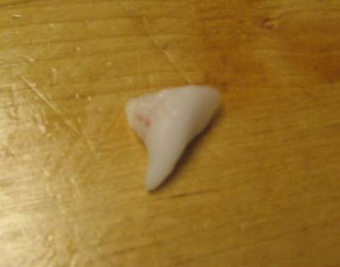 Cheap Comfortable Fangs : 5 Steps (with Pictures) - Instructables