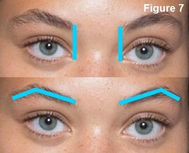 Eyes