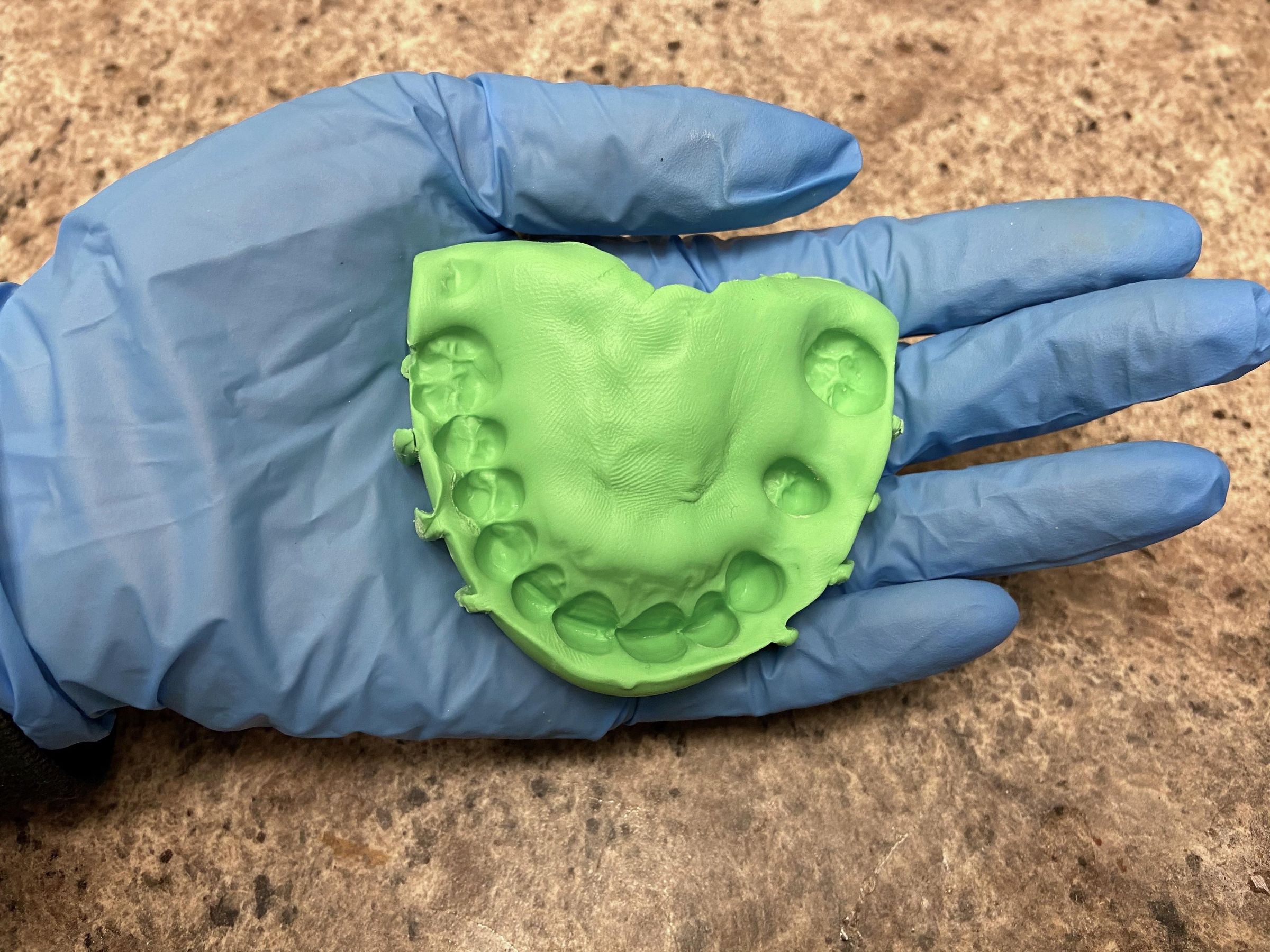 DY Denture Craftng Kt for Begnners - Full Denture Partal Denture w