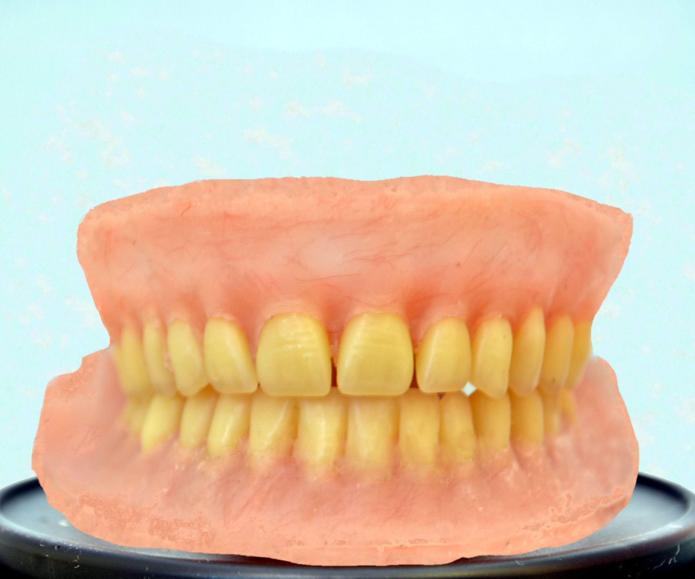 DIY Dentures : a Post-Surgical Plan