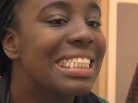 How-to Prevent Gingivitis