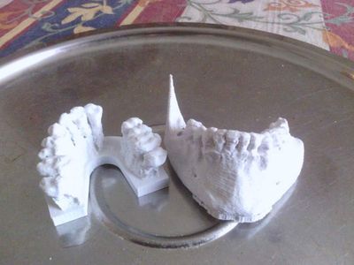 Riproduzione Arcatura Dentale