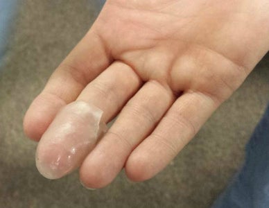 Trim Excess and Final Shaping