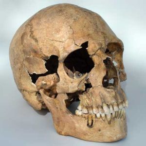 The Skull, Wound and the Spine
