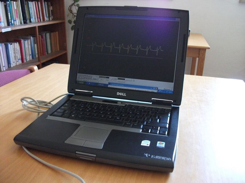 ECG on your laptop!
