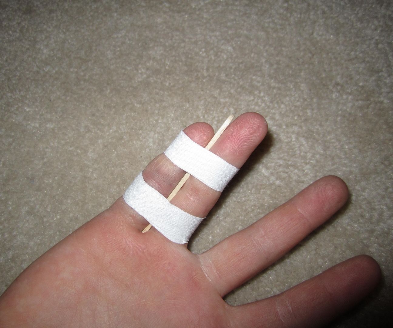Easy Finger Brace
