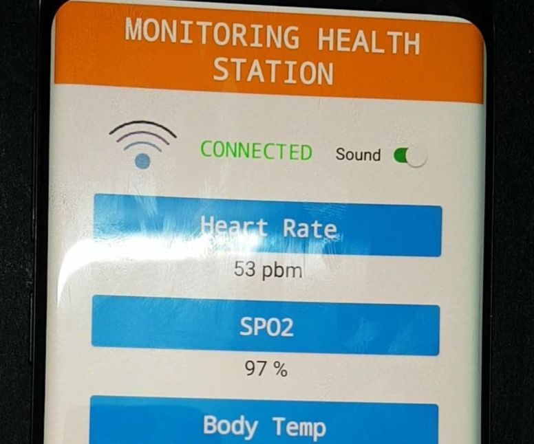 Patient Monitor Using Arduino Uno