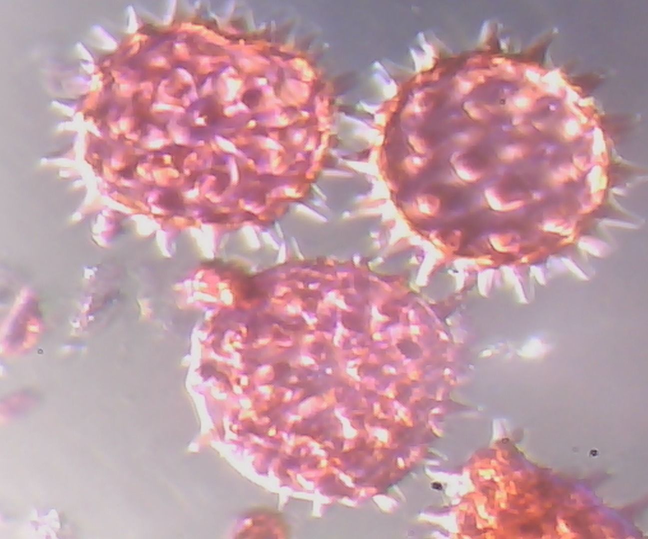 Convert Any Microscope Into Digital Microscope With Just $20