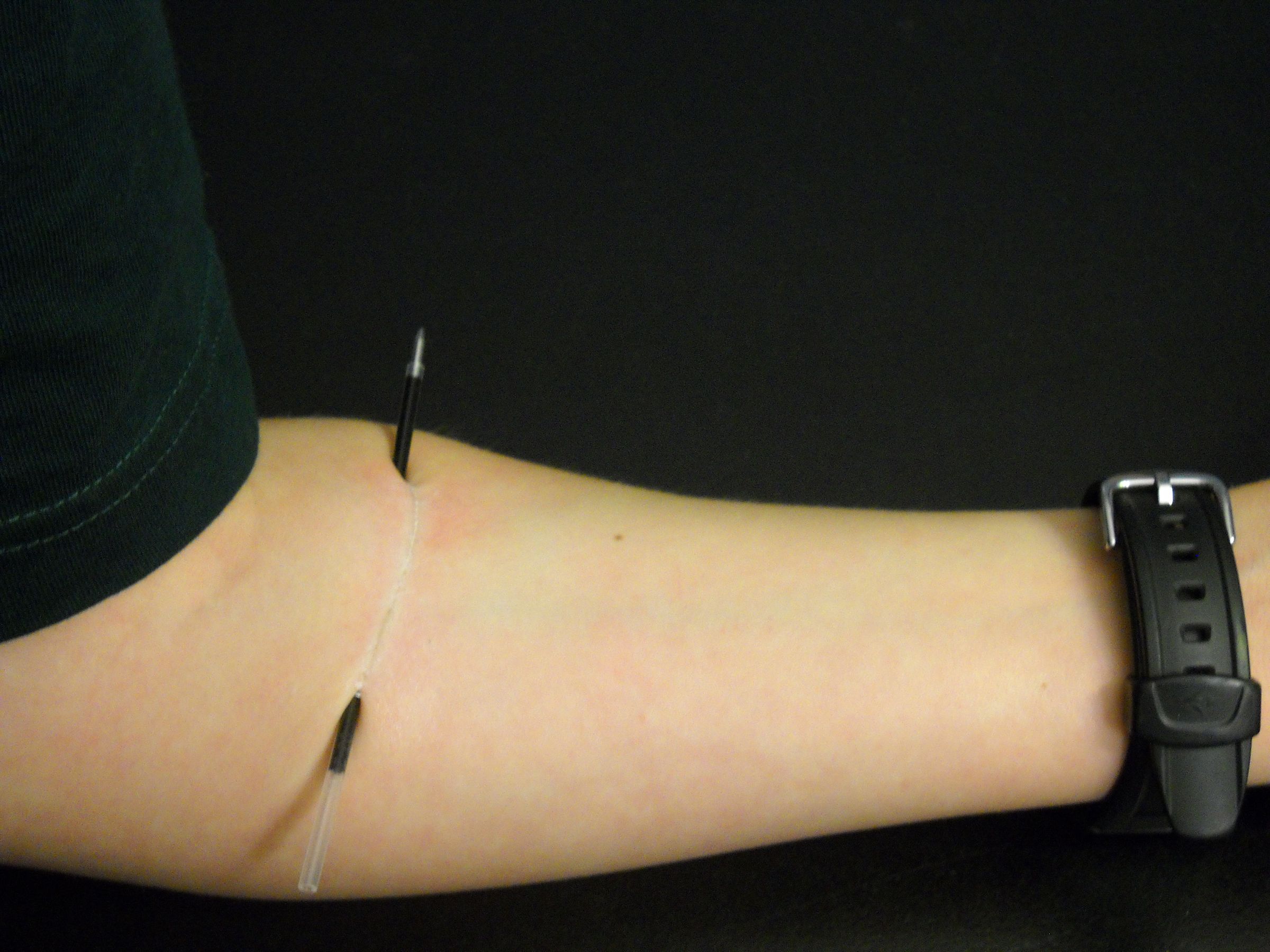 Pen Through Arm Magic Trick/Prank