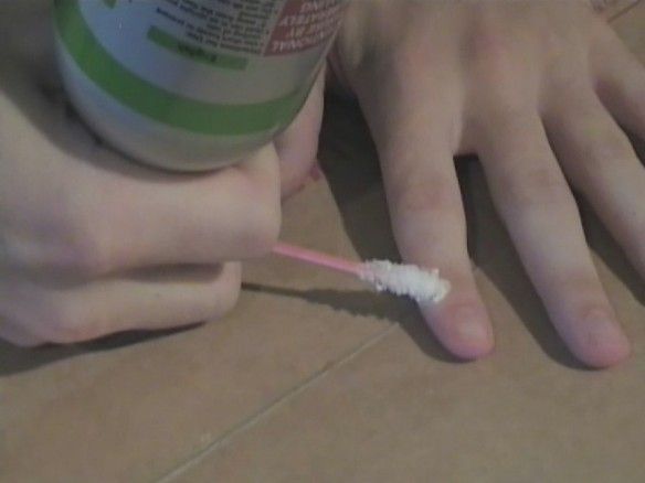 The Wart Freezing Gun