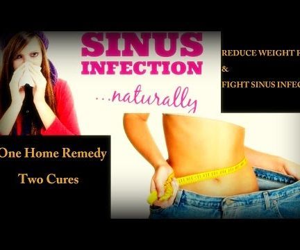 How to Lose Weight Fast and Easy Without Exercise - Sinus / Cold Remedy Too - Natural Home Remedy