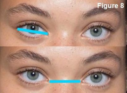 Eyes