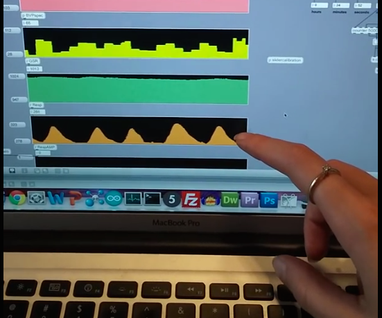Basic Belt Respiration Sensor