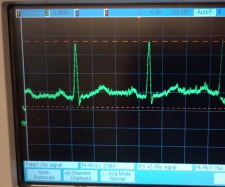 Arduino Display of Filtered ECG Signal : 6 Steps - Instructables