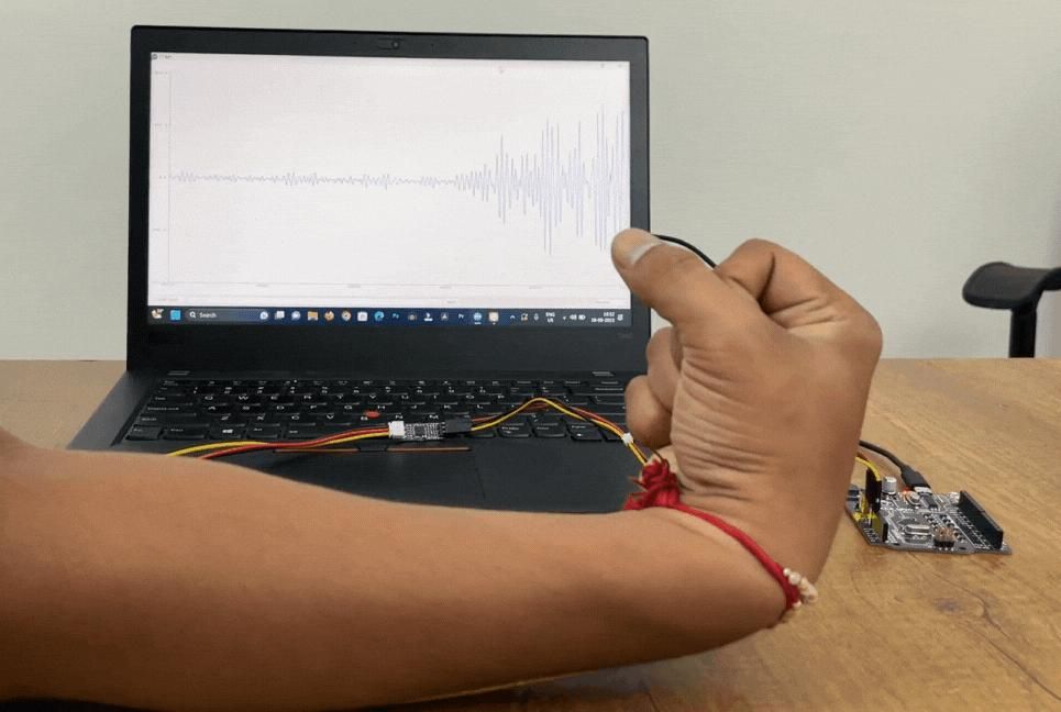 Recording Publication Grade Muscle Signals Using BioAmp EXG Pill