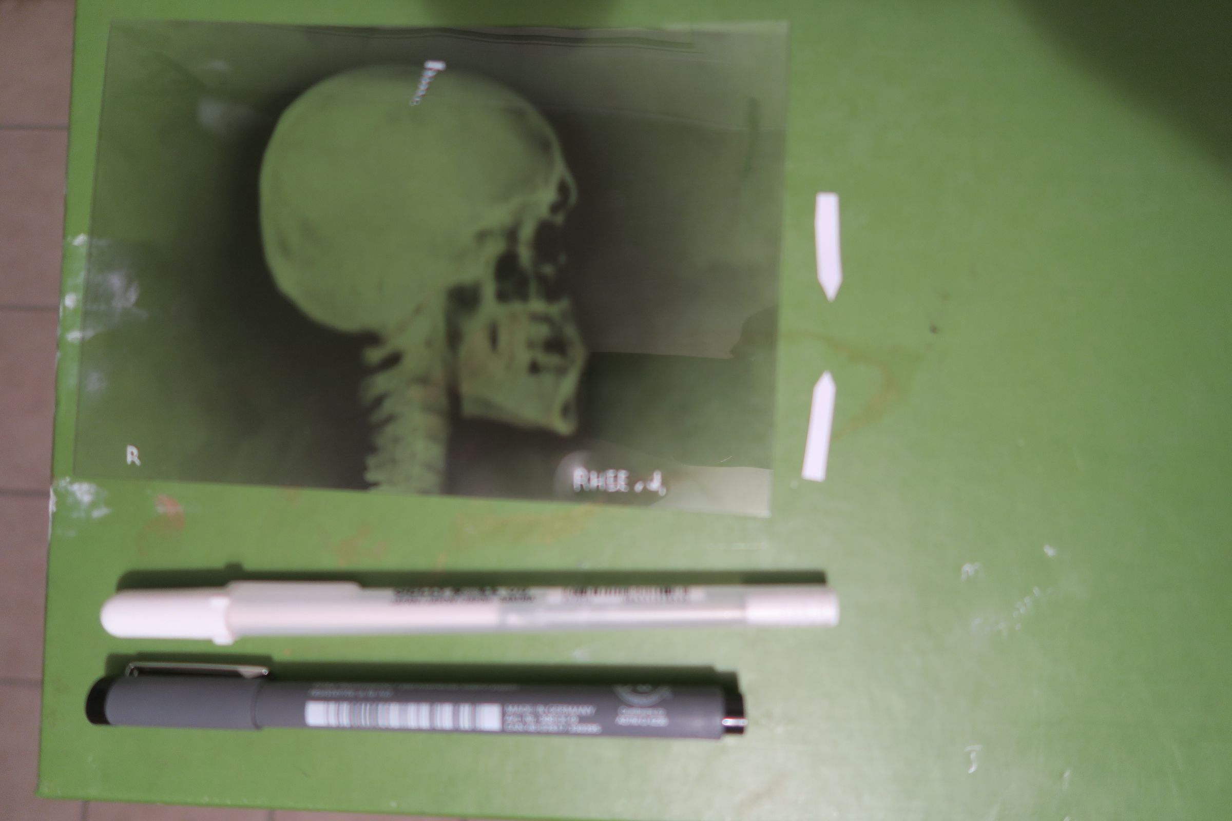 X-Ray Light : 7 Steps (with Pictures) - Instructables
