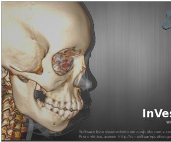 An English Translation of InVesalius