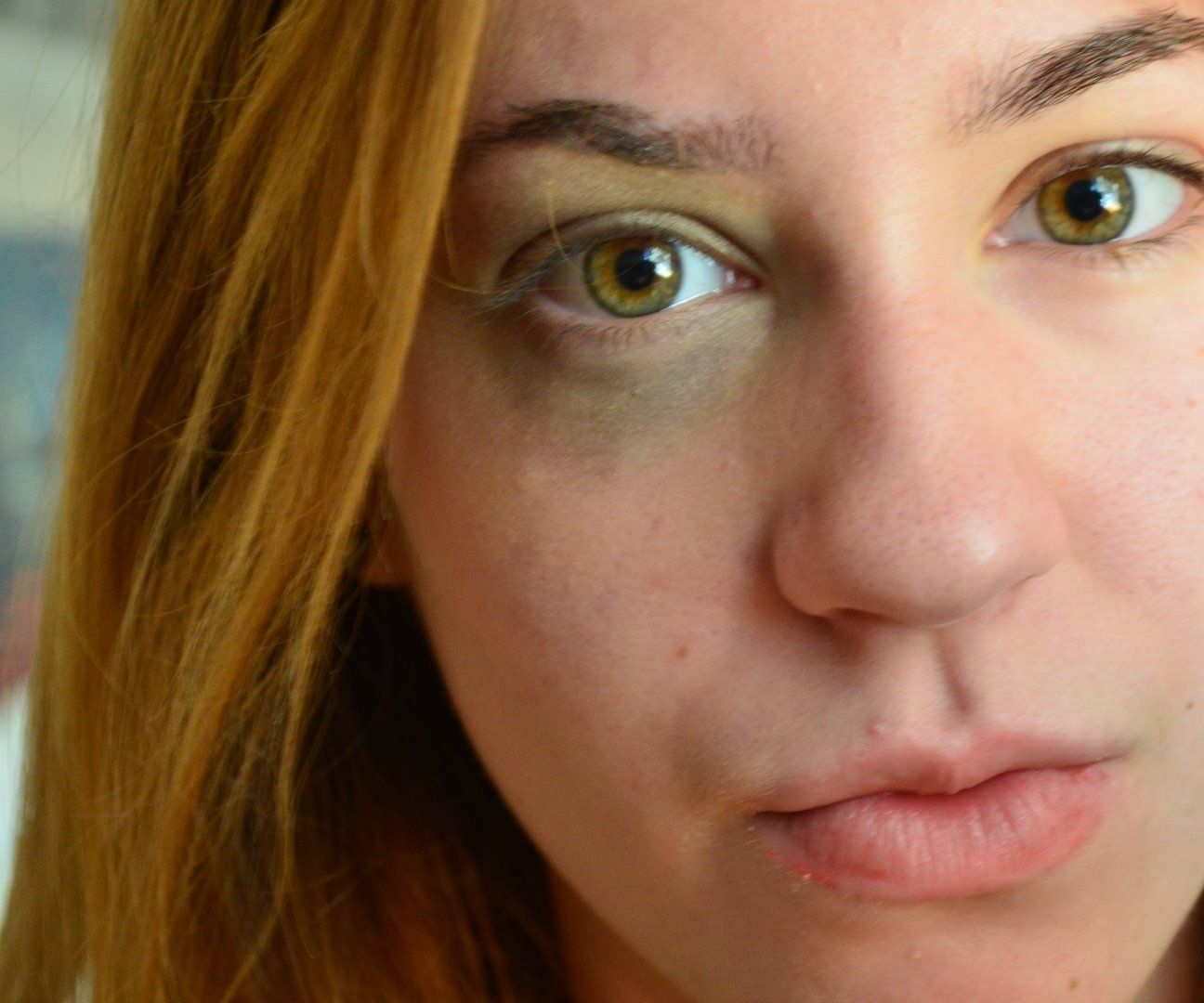 How to Make a Bruise