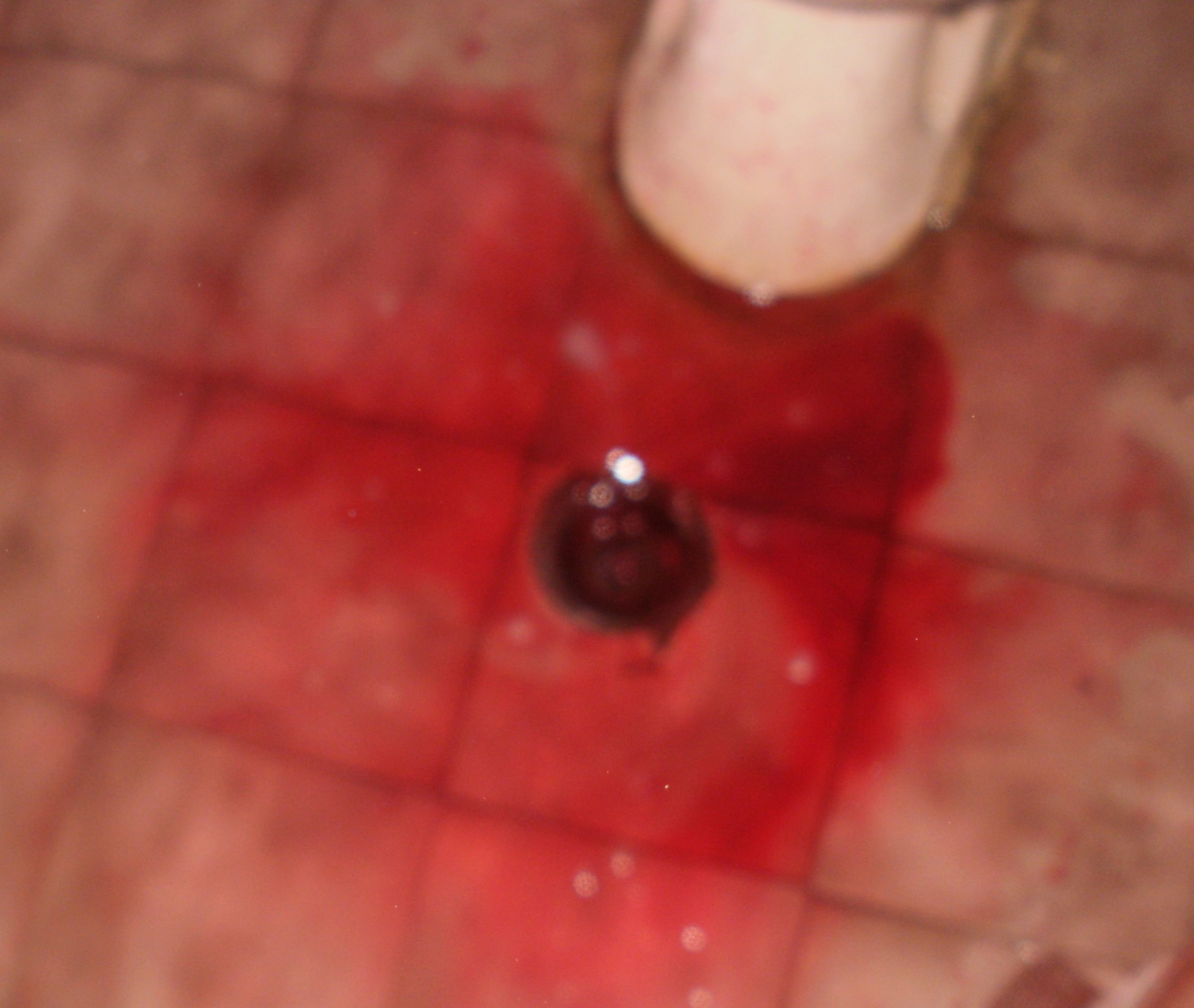 Shower Of Blood