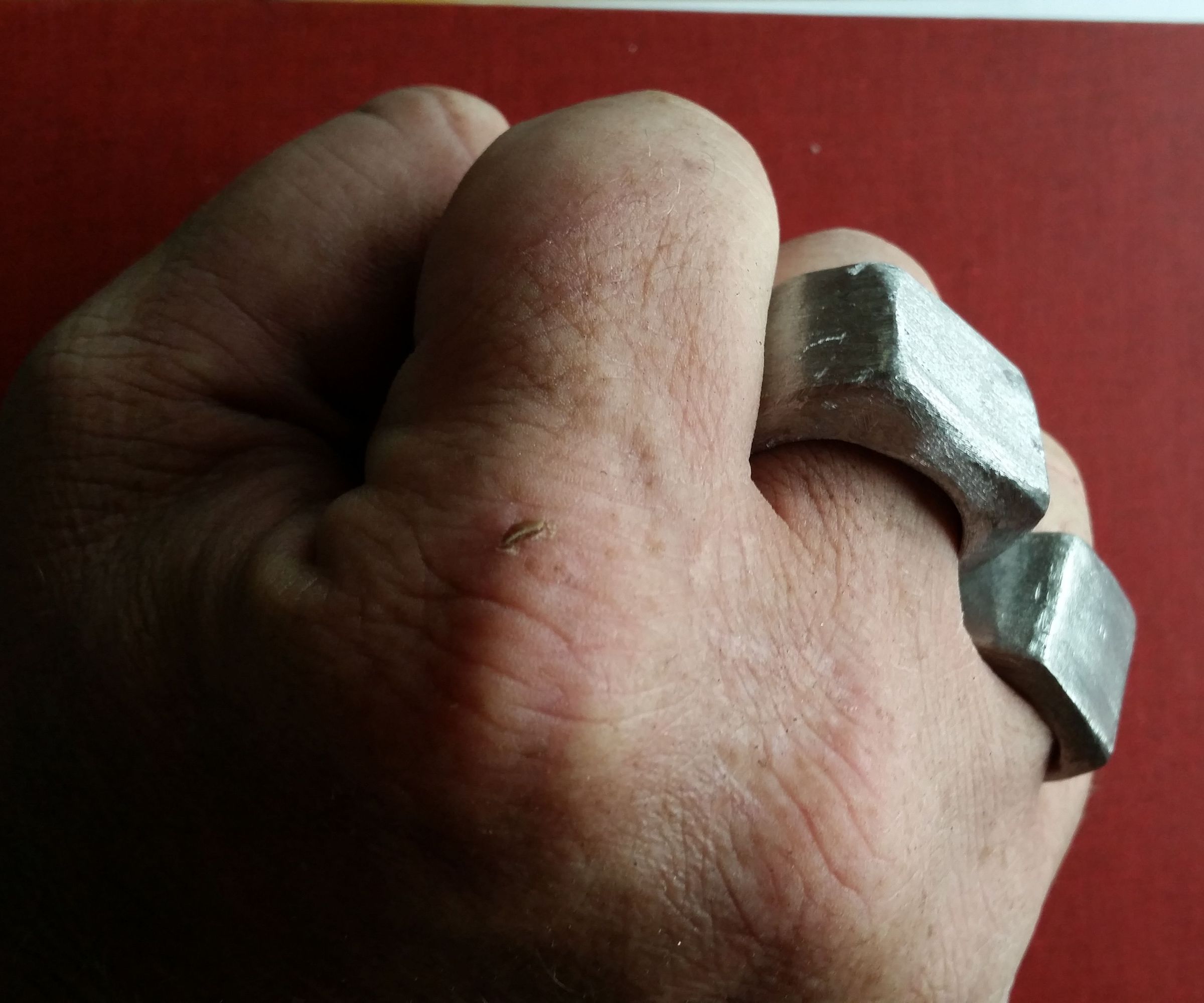 Remix: Metacarpal Armor