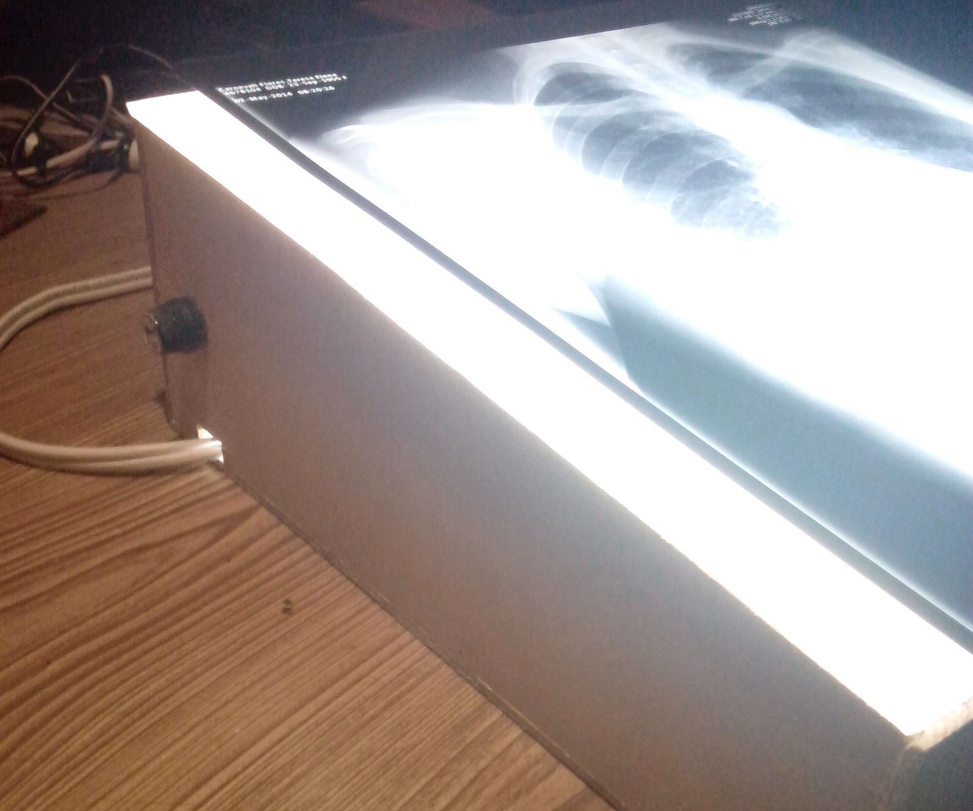 DIY Negatoscope
