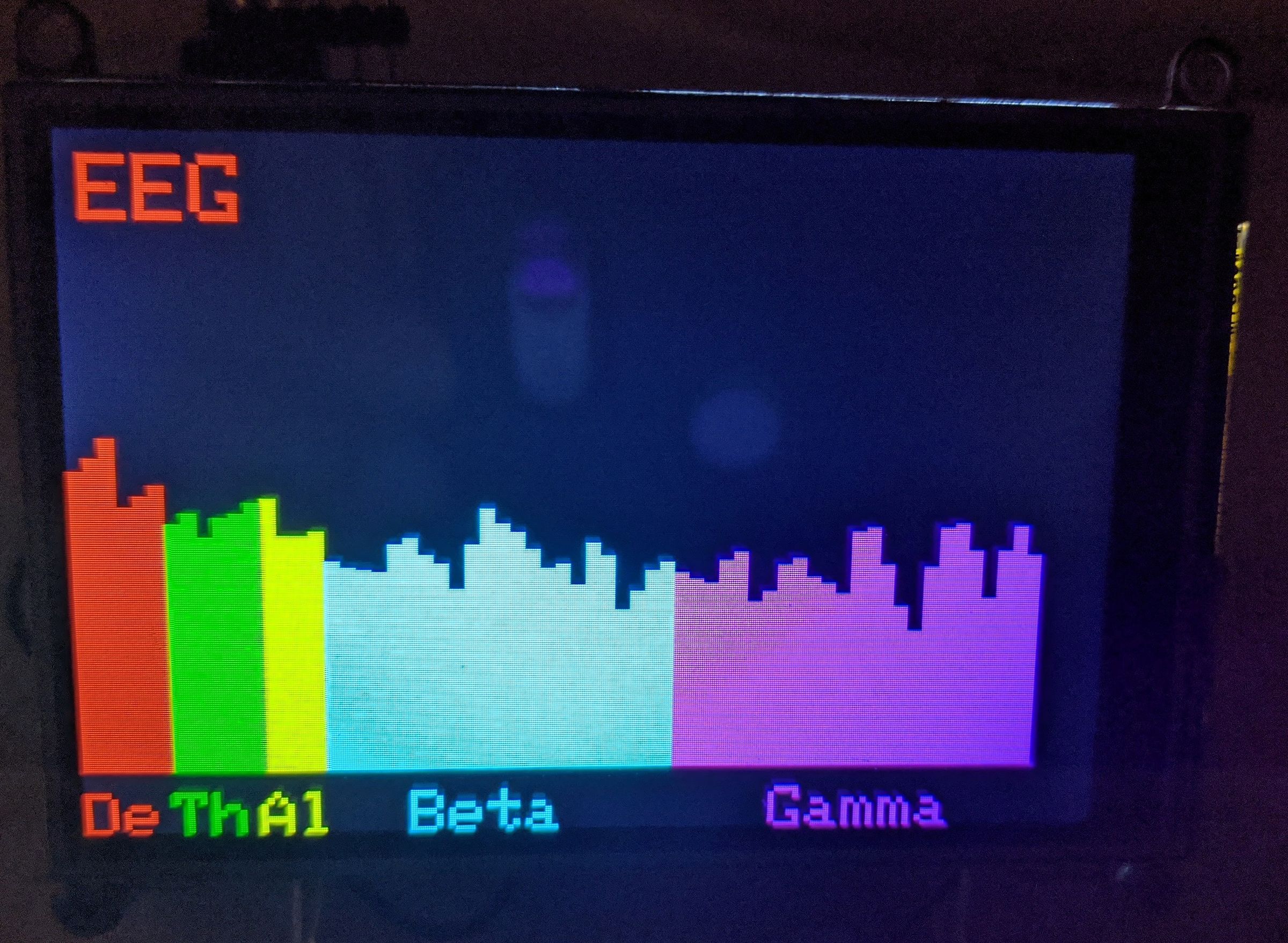 EEG AD8232 Phase 1 : 5 Steps - Instructables