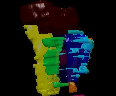 How to Make a 3D-Printable CAD Model From MR Scans