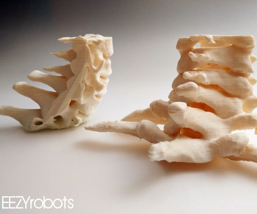 3D Printed Cervical Spine