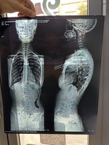 Position the Patient (chest X Ray)