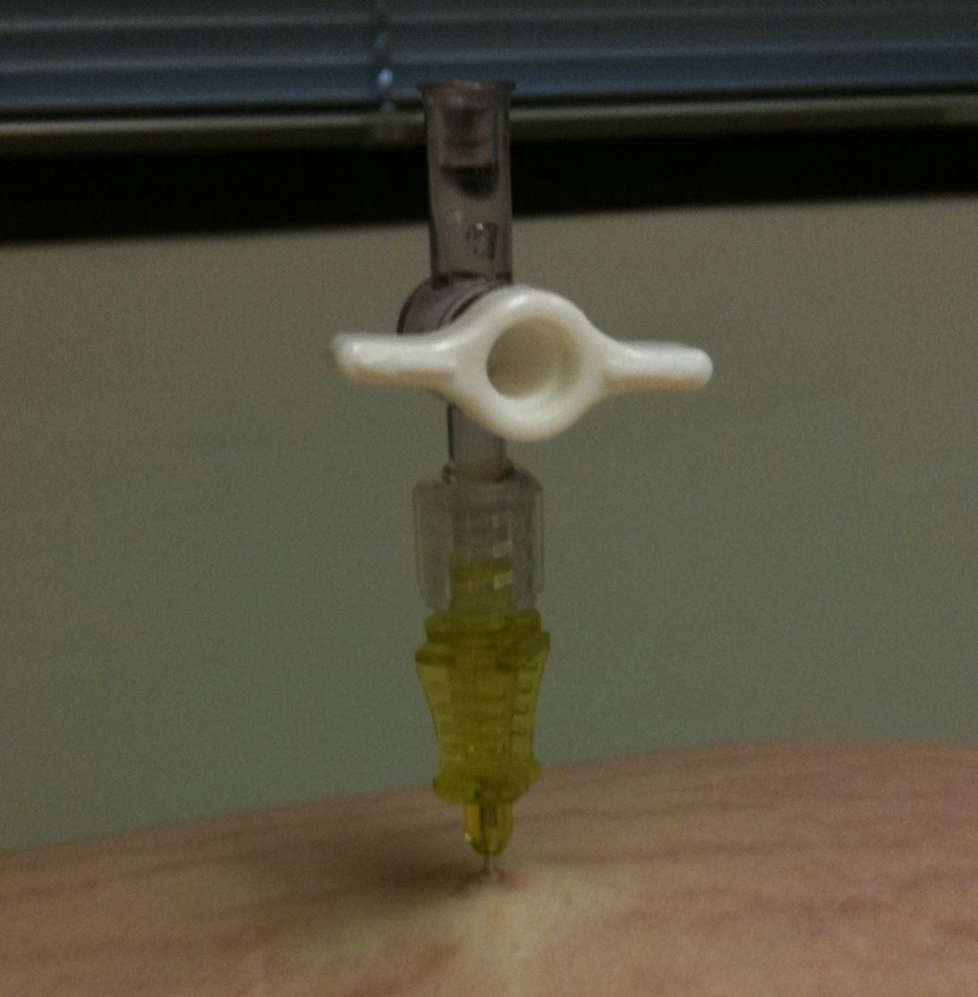 LAP BAND Diet 6 Steps Instructables