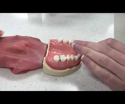 Placing & Removing Elastic Spacers