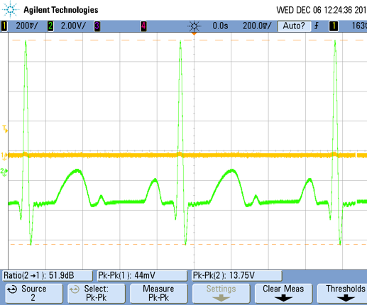 Digital ECG and Heart Rate Monitor