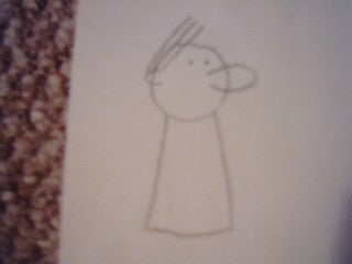YAYYY! He Is Getting Hair!
