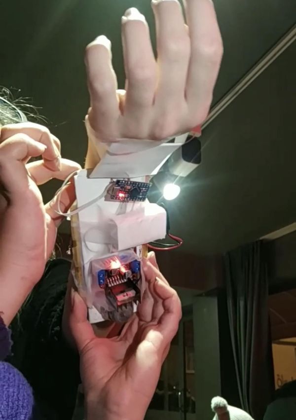 Wrist Posture