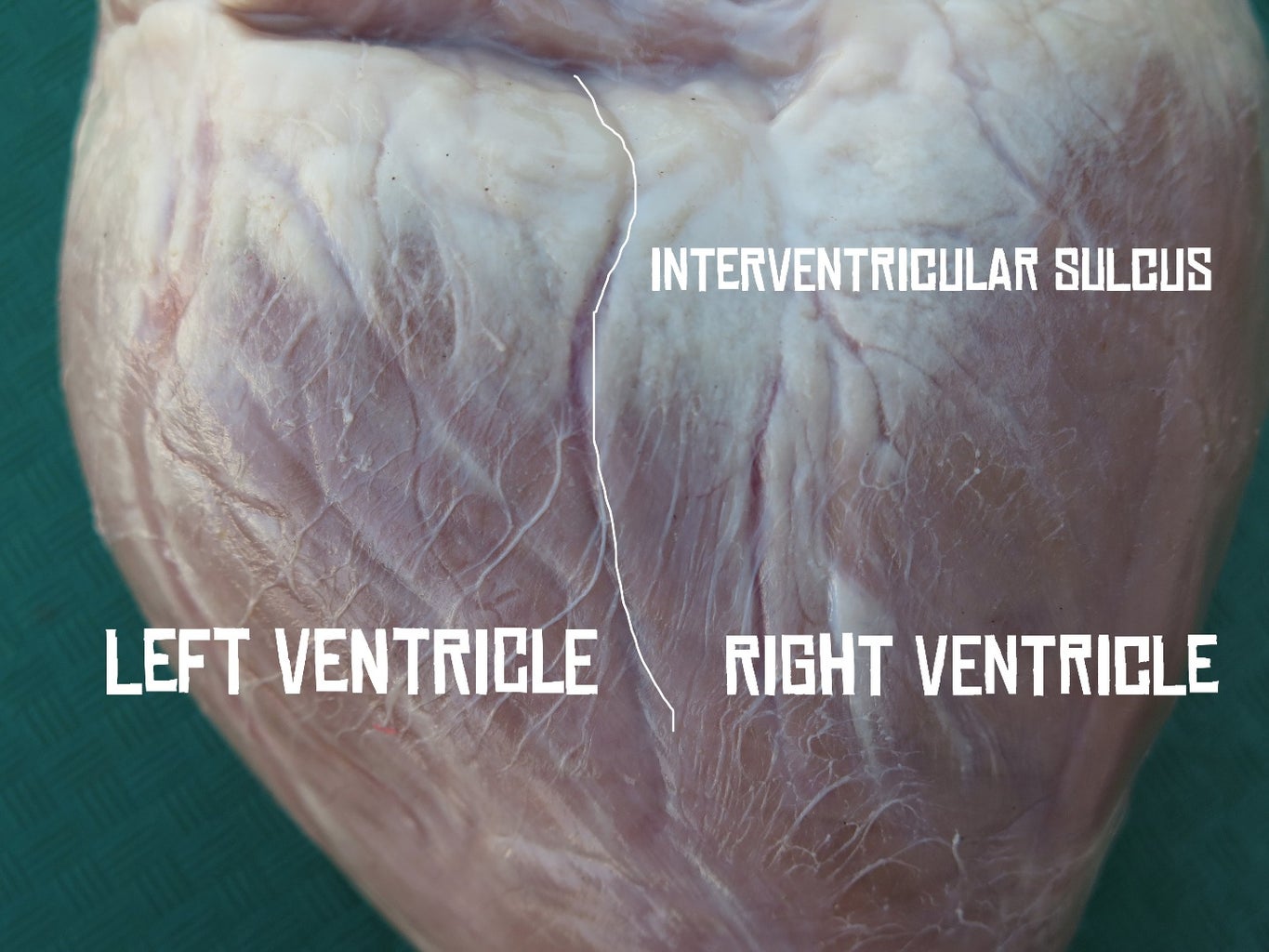 Heart Dissection : 8 Steps (with Pictures) - Instructables