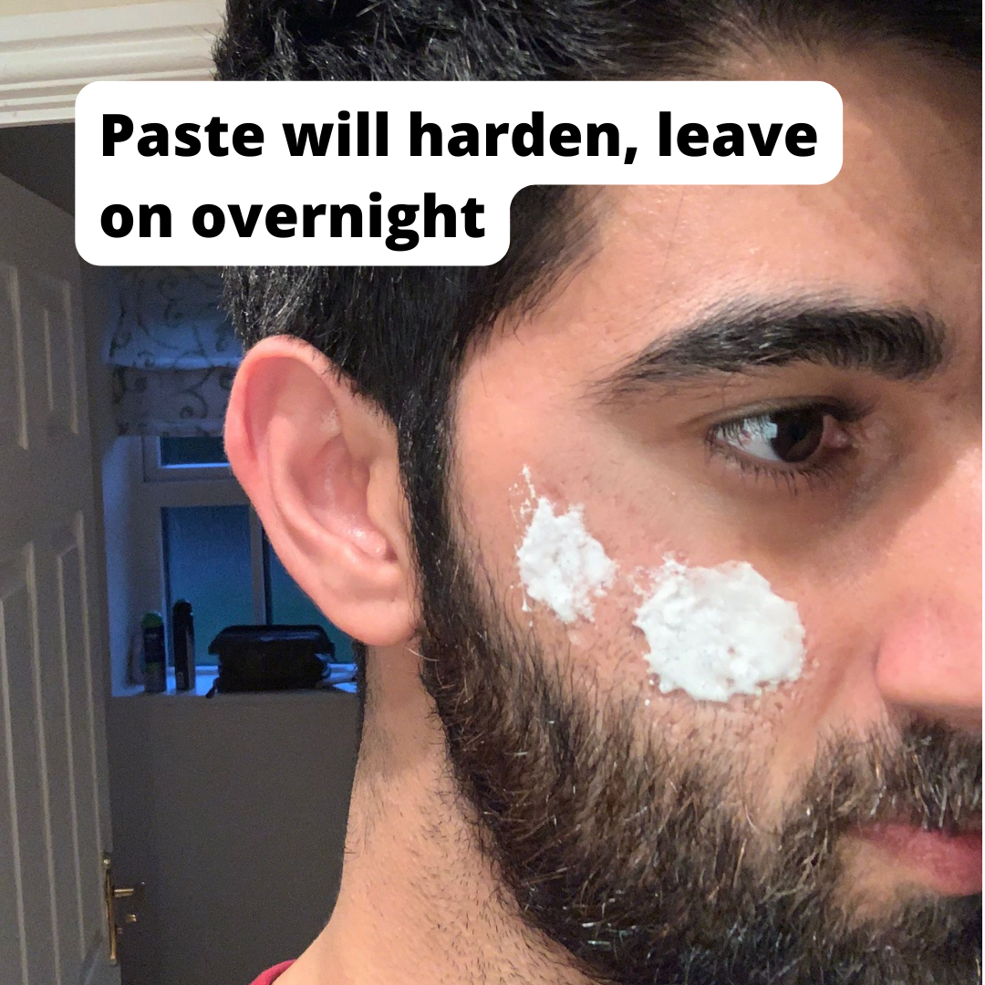 Home Remedies to Reduce Acne Redness Overnight 7 Steps Instructables