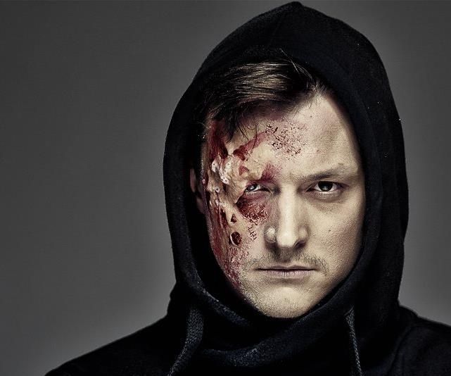 acid burn - sfx makeup tutorial DIY Project DIY Project Image