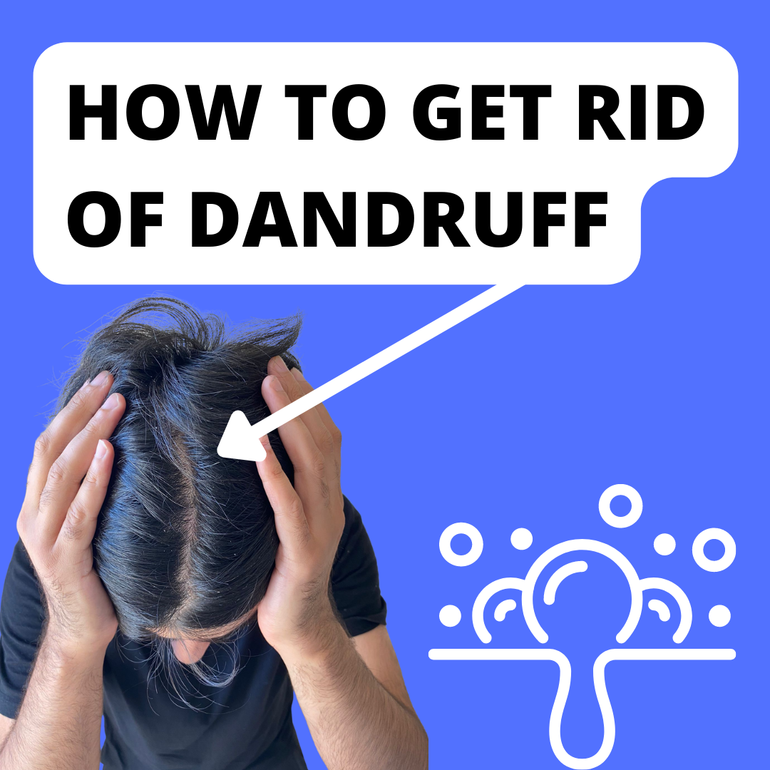 How to Get Rid of Dandruff 3 Steps Instructables